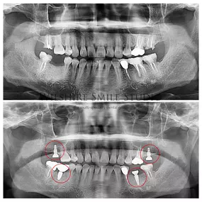 Bild von Los Angeles Oral Surgeon - Dr. Nariman Saadat - Oral Surgery Doctor