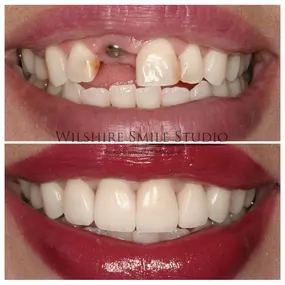 Bild von Los Angeles Oral Surgeon - Dr. Nariman Saadat - Oral Surgery Doctor