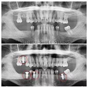 Bild von Los Angeles Oral Surgeon - Dr. Nariman Saadat - Oral Surgery Doctor