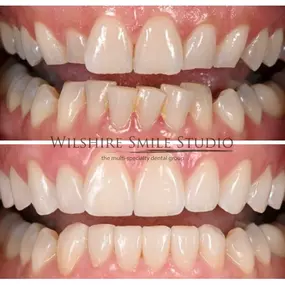 Bild von Dental Veneers Specialist On Wilshire - Los Angeles Cosmetic Dentist