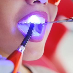 Zahnerhaltung - Zahnarztpraxis Stefan von Ostranitza |  Zahnarzt Zahnersatz Parodontologie | München