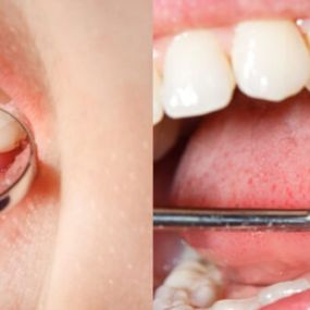 Zahnerhaltung  - Zahnarztpraxis Stefan von Ostranitza |  Zahnarzt Zahnersatz Parodontologie | München