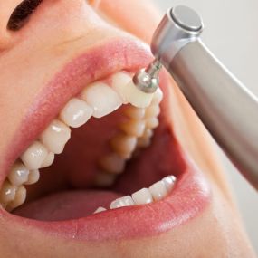 Zahnreinigung - Zahnarztpraxis Stefan von Ostranitza |  Zahnarzt Zahnersatz Parodontologie | München