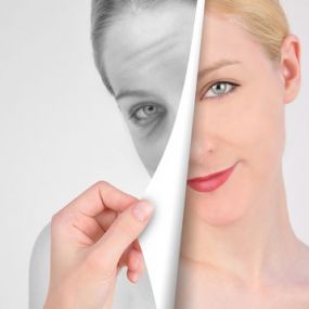 Durch die Mesotherapie lassen sich kleine Schönheitsfehler sowie das Hautbild beeinflussen, ohne operativen Eingriff.