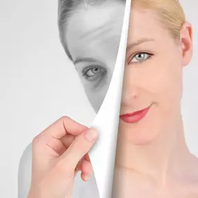 Durch die Mesotherapie lassen sich kleine Schönheitsfehler sowie das Hautbild beeinflussen, ohne operativen Eingriff.