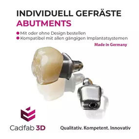 CADfab3D – Ihr Partner für digitale Zahntechnik in Hilden