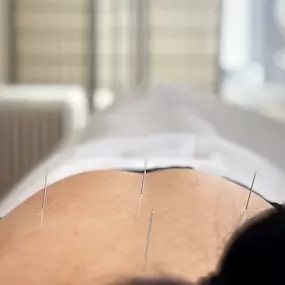 Bild von China Clinic TCM