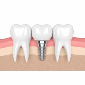 Bild von Nicolas Gabutti Praxis für unabhängige Zahnarzt Zweitmeinung