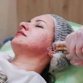 Ausbildung und Weiterbildung Kosmetik - Eine Schulung zum Umgang mit einem Hyaluron Pen ist eine spezifische Ausbildung, die darauf abzielt, Fachleute im Bereich der ästhetischen Medizin oder Kosmetik in der Anwendung dieser Technik zu schulen. Der Hyaluron Pen ist ein Gerät, das verwendet wird, um Hyaluronsäure ohne Nadeln in die Haut einzubringen, um Volumen zu erhöhen, Falten zu reduzieren und das allgemeine Erscheinungsbild der Haut zu verbessern.