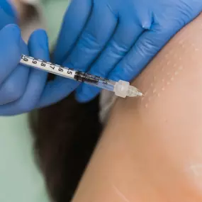 Ausbildung und Weiterbildung Kosmetik - Eine Mesotherapie-Schulung ist eine spezialisierte Ausbildung für medizinisches Fachpersonal, das die Technik der Mesotherapie erlernen und anwenden möchte. Mesotherapie ist eine nicht-chirurgische Behandlungsmethode, bei der spezielle Wirkstoffe (wie Vitamine, Mineralien, Aminosäuren) mittels Injektionen in die Haut eingebracht werden, um verschiedene ästhetische Probleme zu behandeln, die von Falten und feinen Linien bis hin zu Cellulite und Haarausfall 