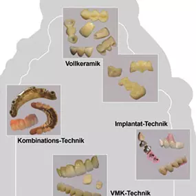 Bild von Dentallabor Esthetic-Line e.K.