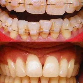 Bild von ORTHOLIGHT Orthodontie