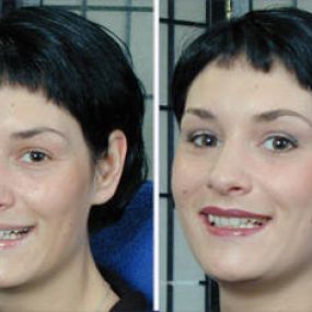 makeup | Praxis für med. Kosmetik | Diana Larisch |München