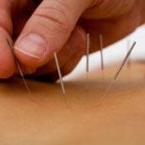 Bild von Akupunktur-Praxis TCM