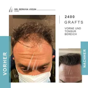 Bild von Dr Serkan Aygin | Niederlassung Köln | Haartransplantation Türkei