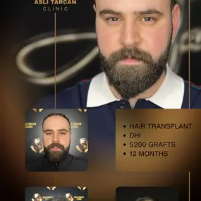 Bild von Asli Tarcan Clinic | Haartransplantationen in der Türkei Istanbul