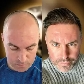 Bild von Asli Tarcan Clinic | Haartransplantationen in der Türkei Istanbul