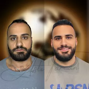 Bild von Asli Tarcan Clinic | Haartransplantationen in der Türkei Istanbul
