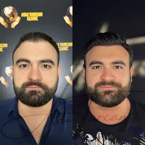 Bild von Asli Tarcan Clinic | Haartransplantationen in der Türkei Istanbul