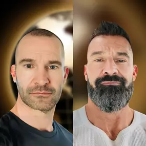 Bild von Asli Tarcan Clinic | Haartransplantationen in der Türkei Istanbul
