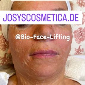 Bild von Kryolipolyse Beauty Queen Josys cosmetica