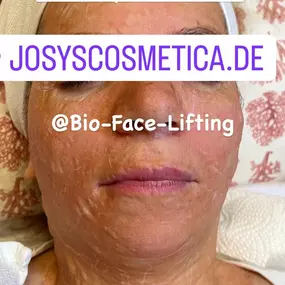 Bild von Kryolipolyse Beauty Queen Josys cosmetica