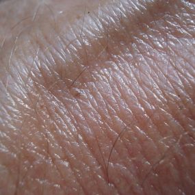 Haut | Hautarztpraxis | Dr. med. Rosita Süß | München