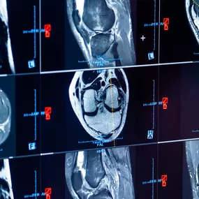Bild von Dr. Lins | Ihre MRT Radiologie Privatpraxis Stuttgart | Schnelle Termine Vorsorge und mehr