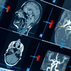 Bild von Dr. Lins | Ihre MRT Radiologie Privatpraxis Stuttgart | Schnelle Termine Vorsorge und mehr