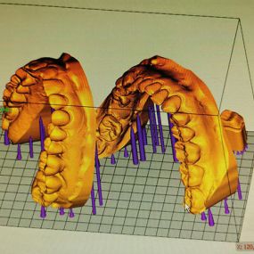 Bild von Dentallabor Hallweger GmbH & Co. KG