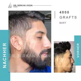 Bild von Dr Serkan Aygin | Niederlassung Berlin | Haartransplantation Türkei