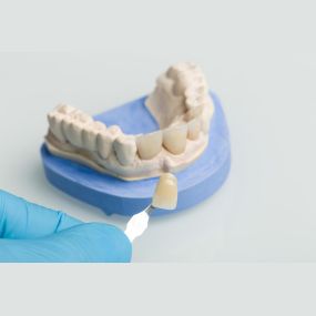 Bild von Dentallabor Gunzelmann