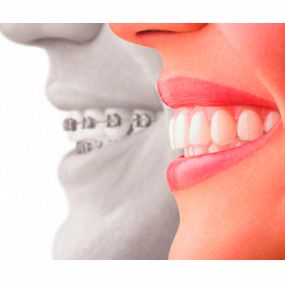 clinica-dental-abando-ortodoncia-02.jpg