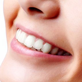 clinica-dental-floranes-dientes-blancos.png