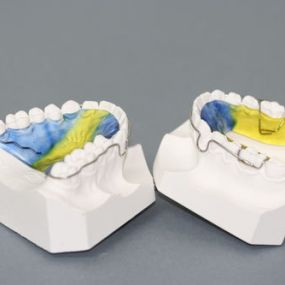 ortodoncia-dental-03.jpg