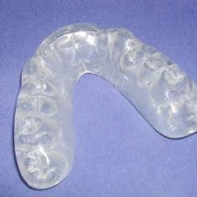 protesis-denta-01.jpg