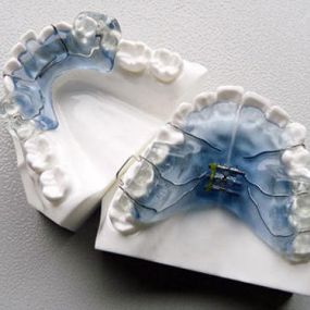 aparatologia-dental-05.jpg