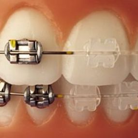 clinica-dental-estoril-ii-9.jpg