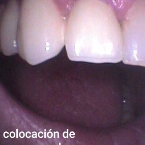 clinica-dental-estoril-ii-5.jpg