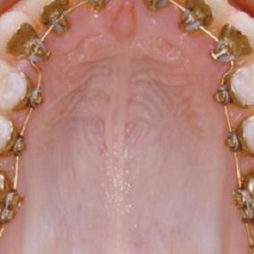 clinica-dental-irene-martinez-ortodoncia-05.jpg