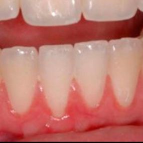 clinica-dental-doctor-ortiz-camarero-dientes-03.jpg