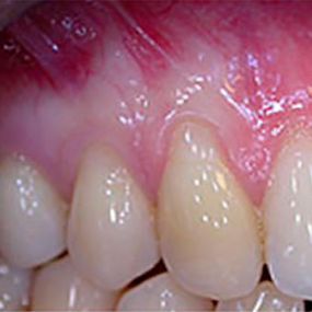 clinica-dental-doctor-ortiz-camarero-dientes-02.jpg