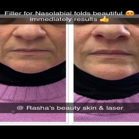 Bild von Rasha's Beauty Skin & Laser