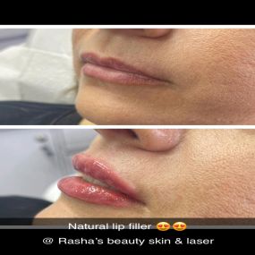 Bild von Rasha's Beauty Skin & Laser