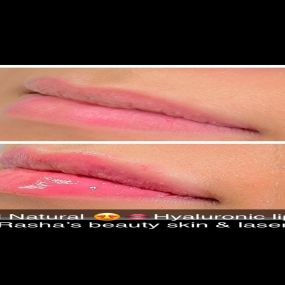 Bild von Rasha's Beauty Skin & Laser