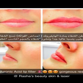 Bild von Rasha's Beauty Skin & Laser