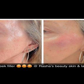 Bild von Rasha's Beauty Skin & Laser