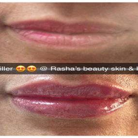 Bild von Rasha's Beauty Skin & Laser