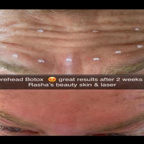 Bild von Rasha's Beauty Skin & Laser