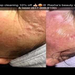 Bild von Rasha's Beauty Skin & Laser